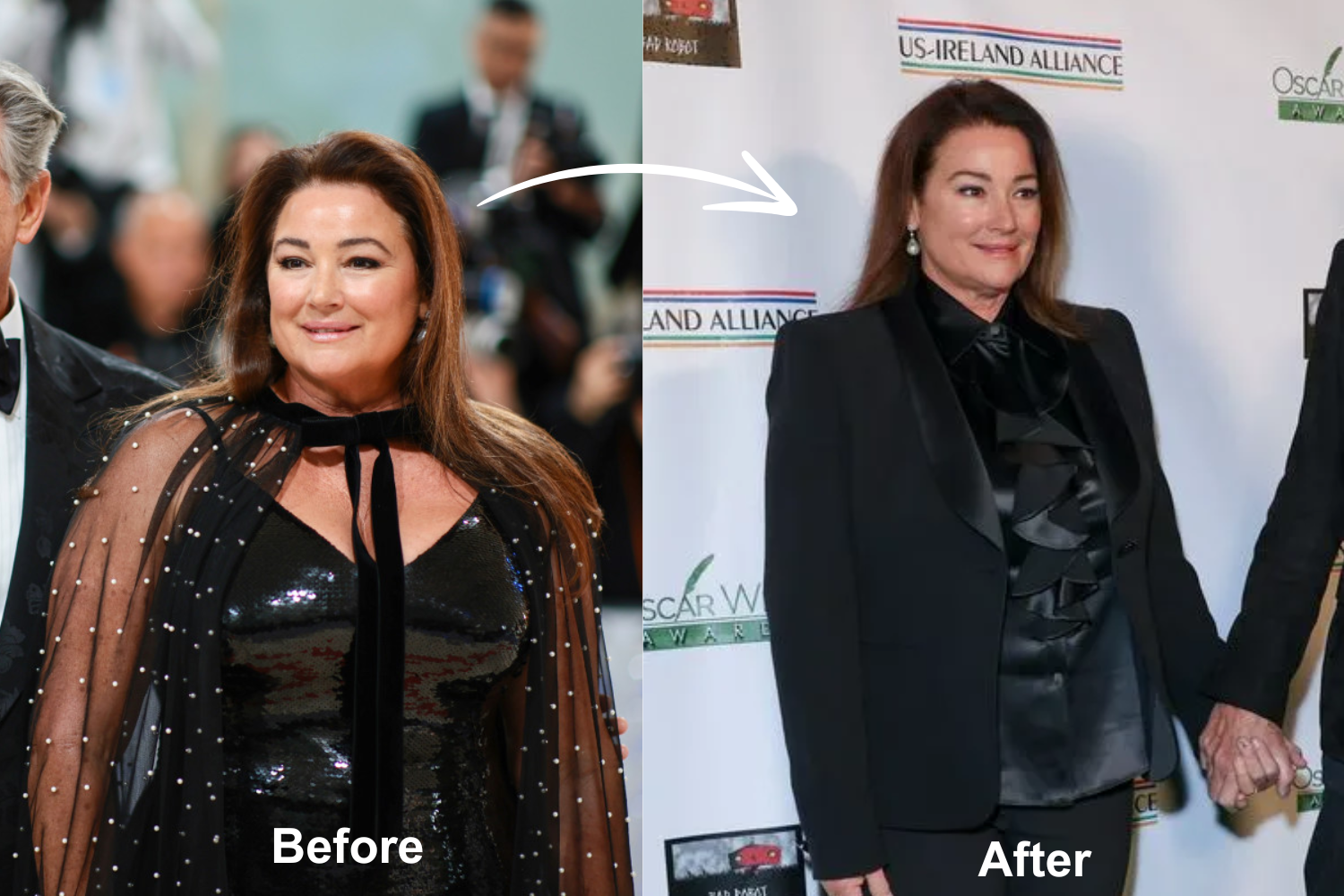 Why Is Pierce Brosnan's Wife So Fat Did Pierce Brosnan's Wife Have Weight Loss Surgery?