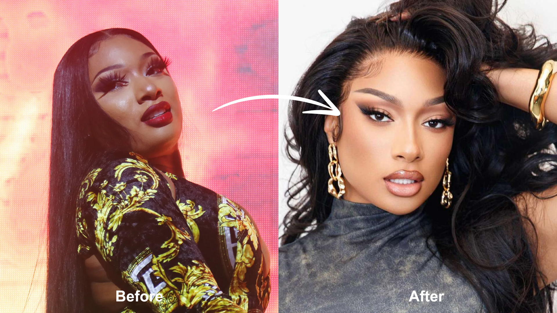 did-megan-thee-stallion-have-weight-loss-surgery-bariatric-journal