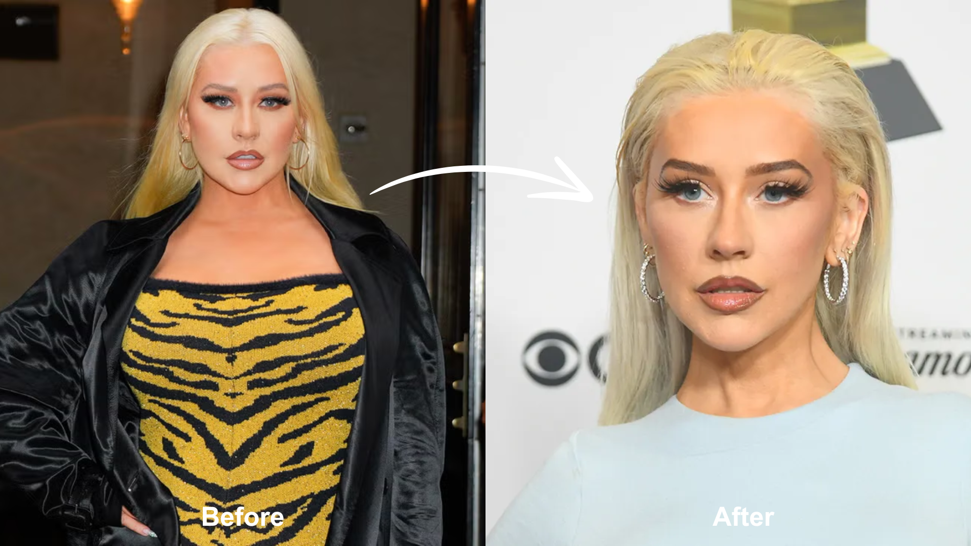 Did Christina Aguilera Have Weight Loss Surgery? - Bariatric Journal