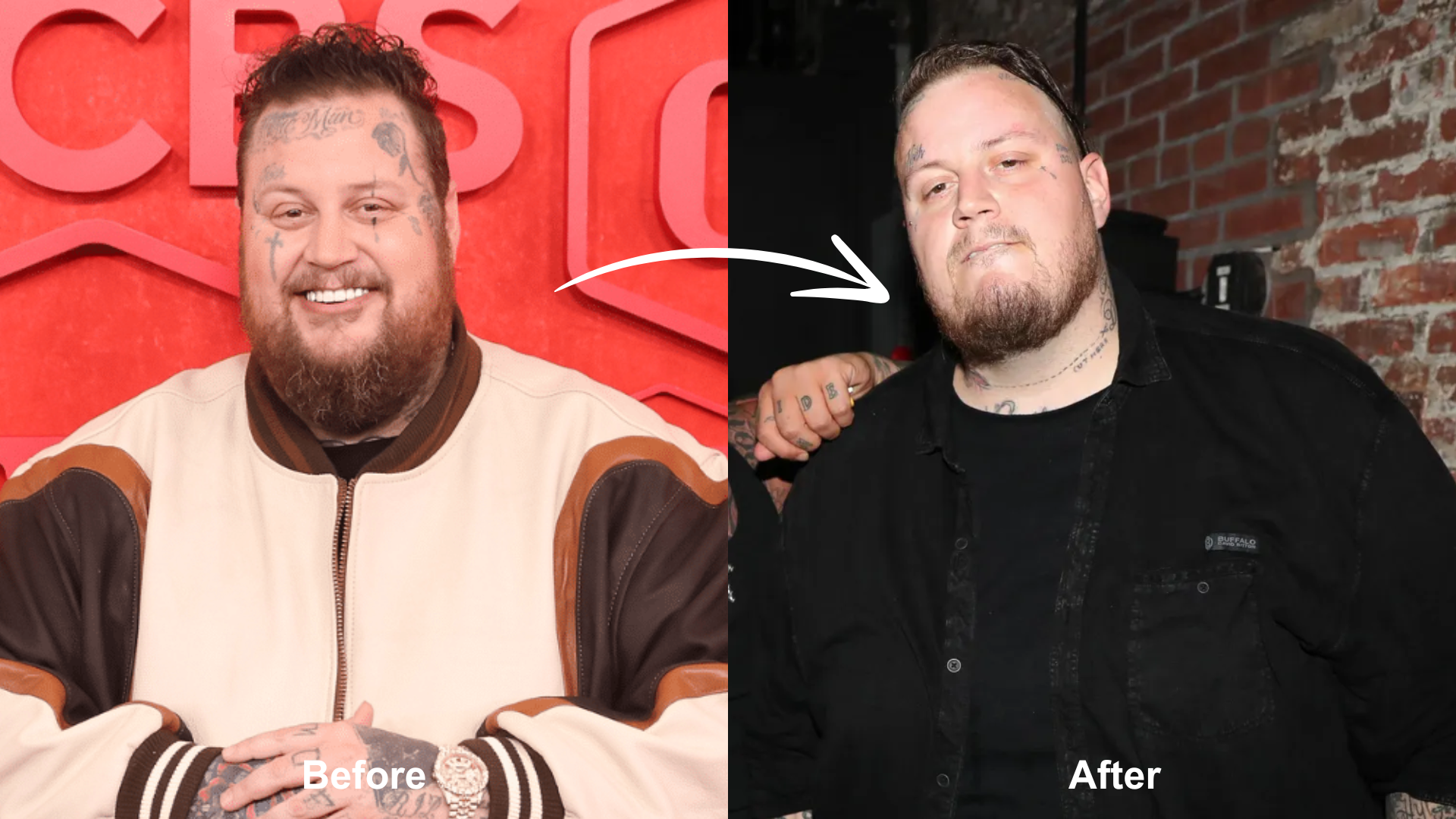 Did Jelly Roll Have Weight Loss Surgery Did jelly roll have weight loss surgery