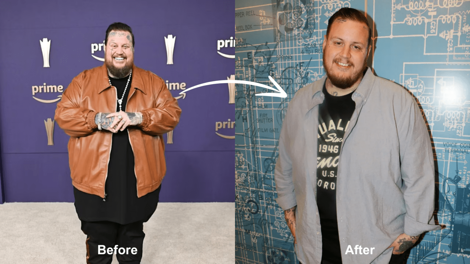 Did jelly roll have weight loss surgery 