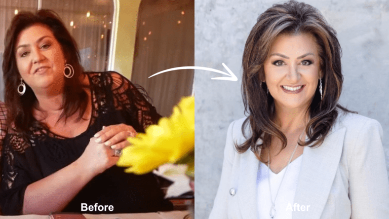 Did Joni Lamb Have Weight Loss Surgery? - Bariatric Journal