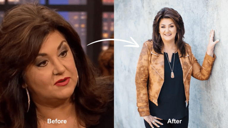 Did Joni Lamb Have Weight Loss Surgery? - Bariatric Journal