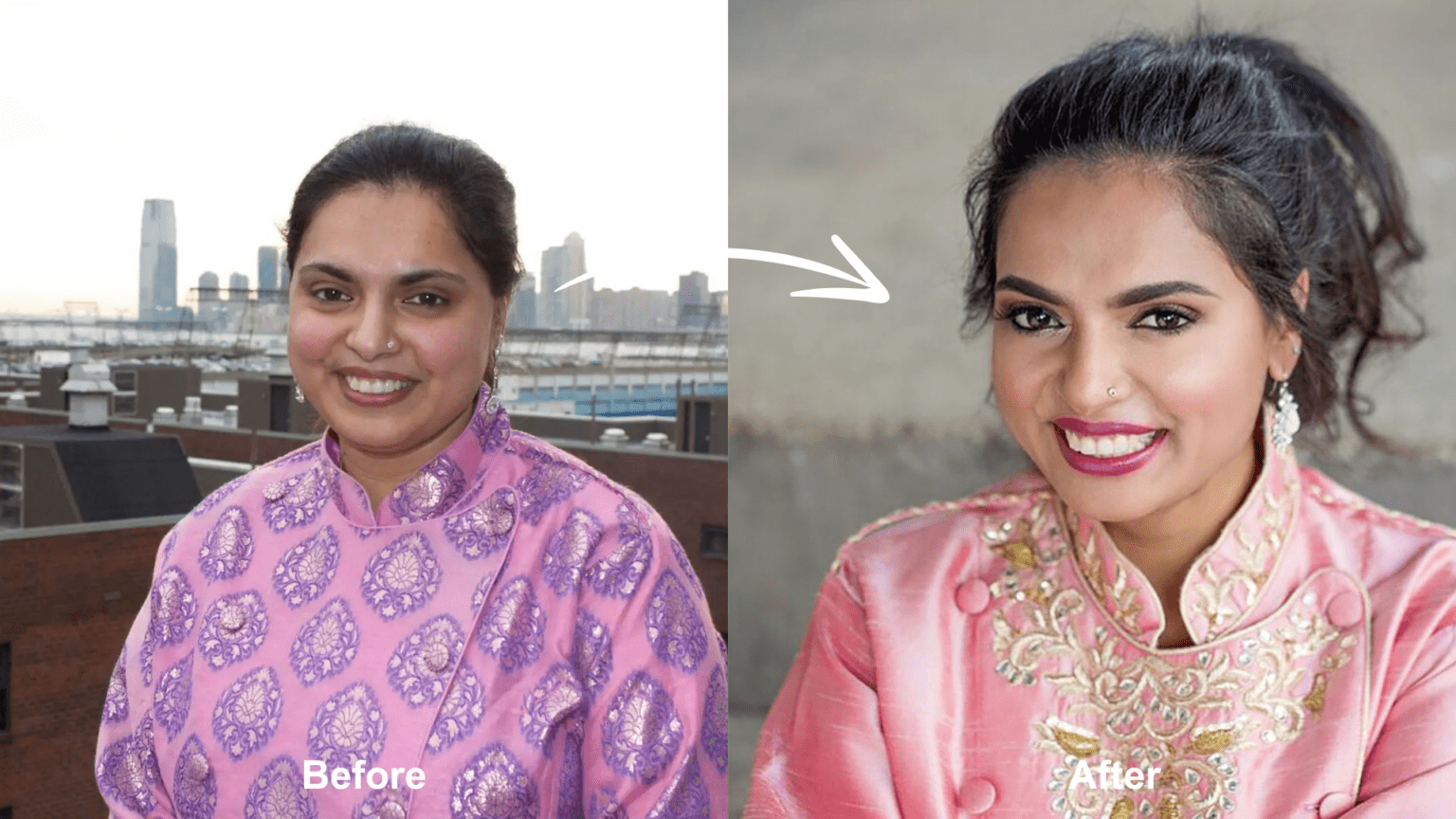 maneet chauhan weight loss surgery Image 5