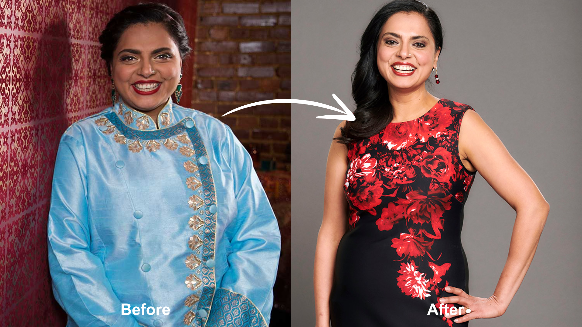 maneet chauhan weight loss surgery Image 6