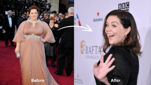 Did Melissa McCarthy Have Weight Loss Surgery? - Bariatric Journal