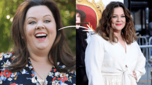 Did Melissa McCarthy Have Weight Loss Surgery? - Bariatric Journal