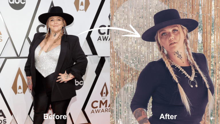 Featured - Elle King Plastic Surgery