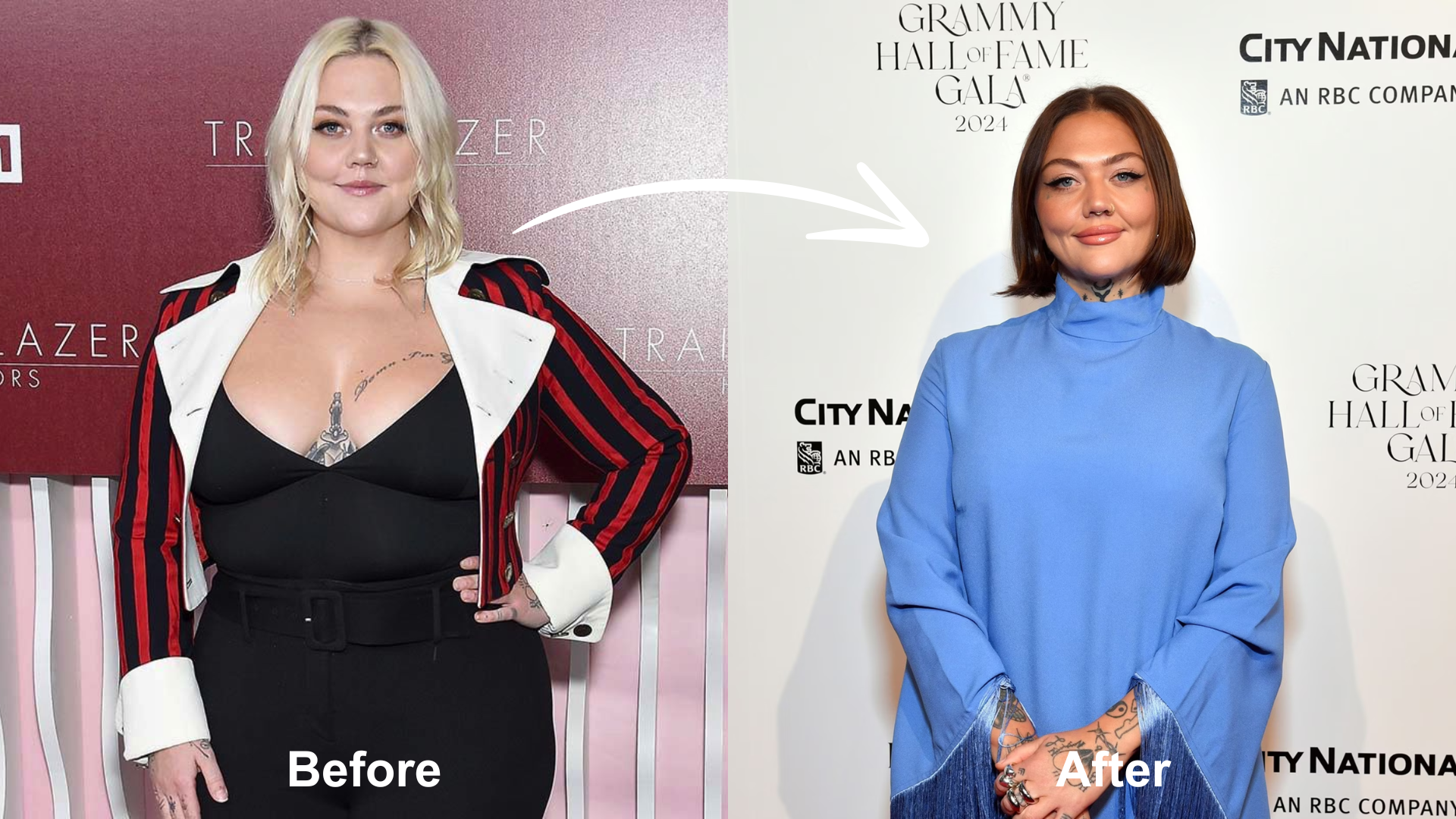 elle king plastic surgery Image 2