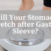Stomach Stretch after Gastric Sleeve